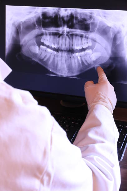 Best Emergency Denture Repair in Patchogue, NY